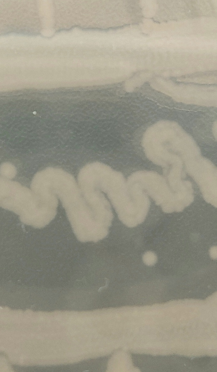 ecoli